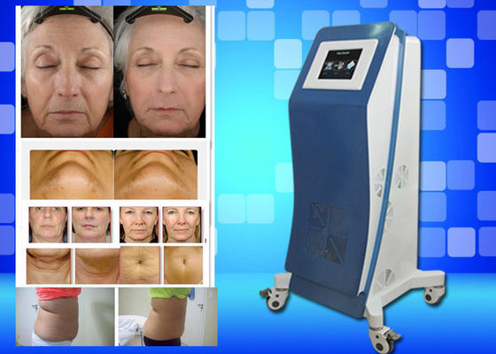 Cryo Freezing Laser Lipo Equipment Weight Lose Home Beauty Machine